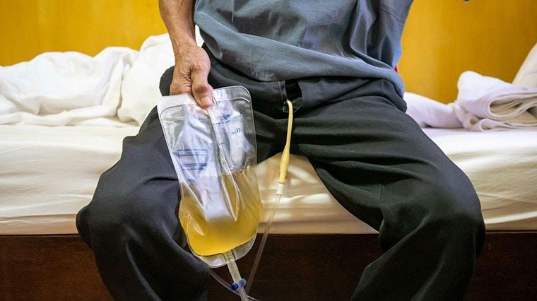 Catheter-Associated Urinary Tract Infections & Sepsis - QuickChange Men's Incontinence Wrap Australia