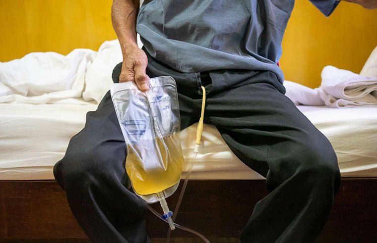Catheter-Associated Urinary Tract Infections & Sepsis - QuickChange Men's Incontinence Wrap Australia